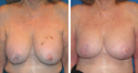 Before & After Photos